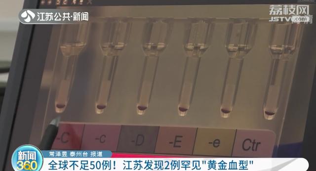 最稀少的黄金血型(江苏发现2例罕见)(4)