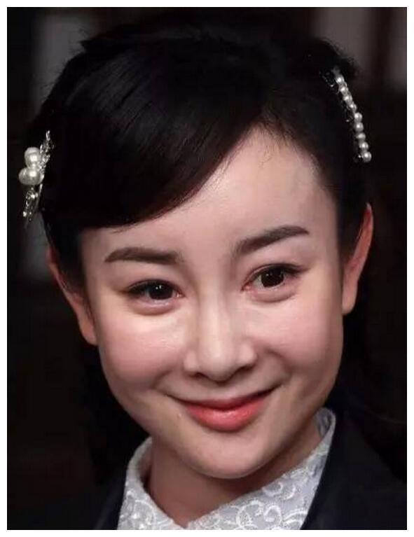 张檬再度整容变毁容，鼻孔朝天双眼皮吓人，脸部僵硬！