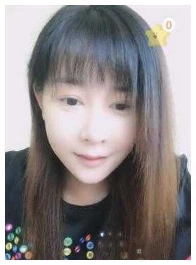 张檬再度整容变毁容，鼻孔朝天双眼皮吓人，脸部僵硬！