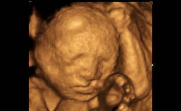 胎儿四维照片丑哭,生出来会不会丑?知道原因后,孕妈可以放心了