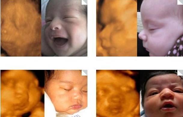 胎儿四维照片丑哭,生出来会不会丑?知道原因后,孕妈可以放心了