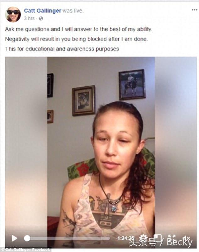 女子尝试在眼球做纹身，结果导致永久性失明，断送了模特生涯