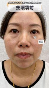 ​一边下奶一吃敷视频60分钟效果立竿见影网友：惊喜无限！