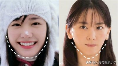 ​女明星也避免不了牙套脸！元气满满的宅男女神颜值跌下神坛