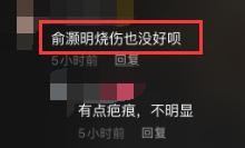 俞灏明烧伤后复出时间（俞灏明在破旧小摊吃馄饨）(13)