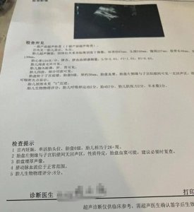 ​孕妇坐动车，怀胎7月的宝宝意外离世！刚刚通报来了