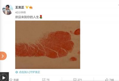 ​《白夜追凶》演员王龙正当爸:欢迎来到你的人生