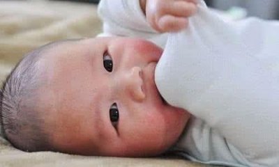 ​崔玉涛推荐：小孩湿疹、婴儿湿疹这样治才科学！宝妈们别再错过