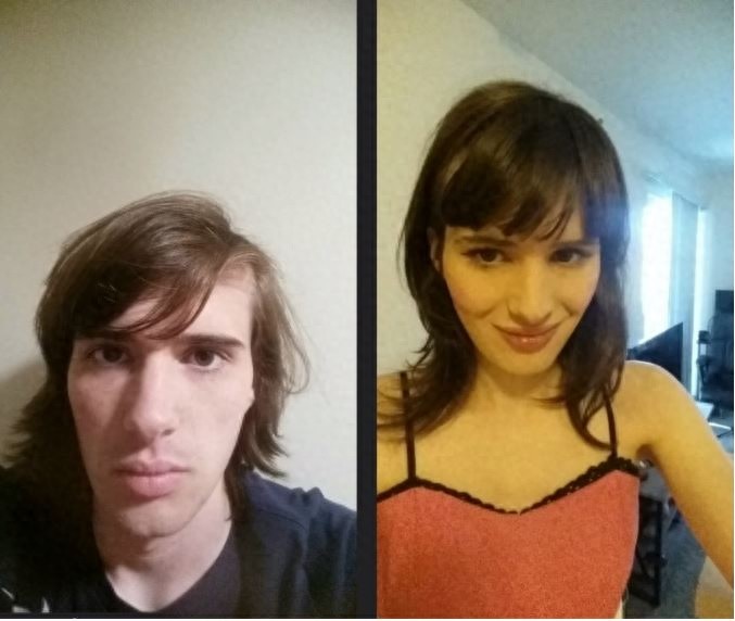 这个男人服用雌激素，17个月由男变女，现已找到男朋友