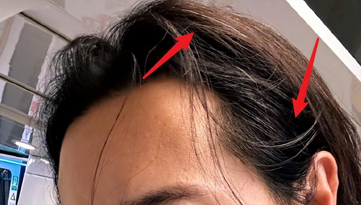 0岁高云翔近况曝光，经济拮据头发胡子白了不少，越来越女性化